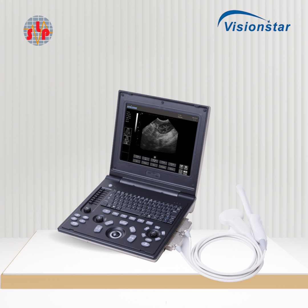 Ultrasonography (Visionstar) – Sinergy Lintas Persada